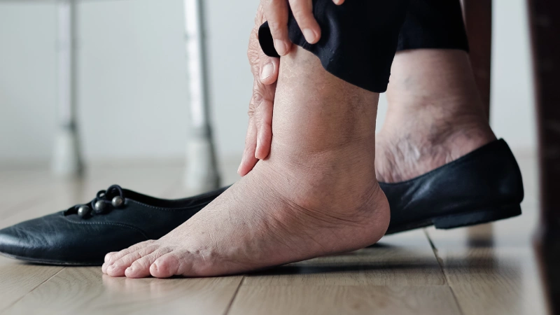 علت آب آوردن مچ پا در افراد مسن