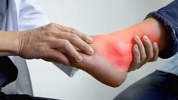 علل سندرم تونل تارسال | دکتر علیرضا موسویان